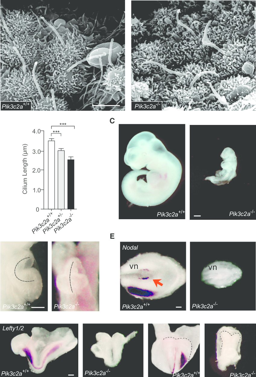 Phenotypes of Pik3c2a Mutant Embryos A SEM analysis of cilia morphology in the ventral fig4