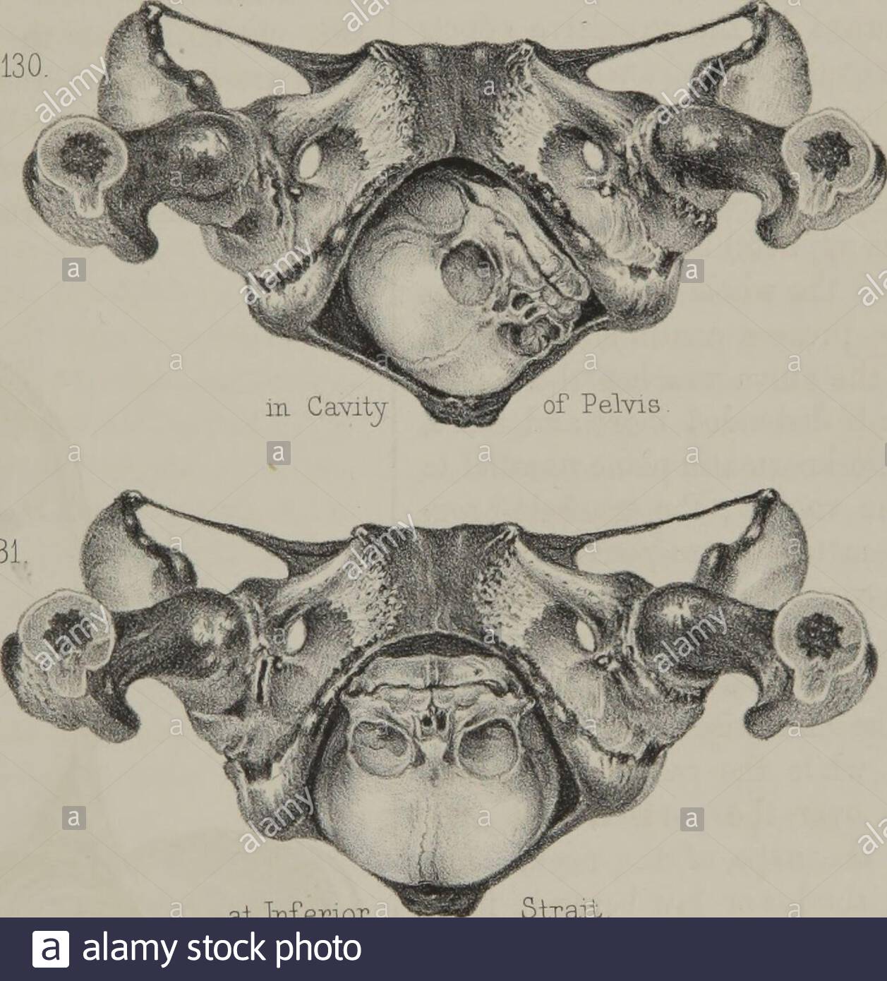 the principles and practice of obstetrics fig 129 4 position of faceal superior strait fig 130 fig 131 at inferior strait fig 132 2AJG3WC